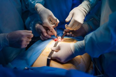 Operation using laparoscopic equipment clipart