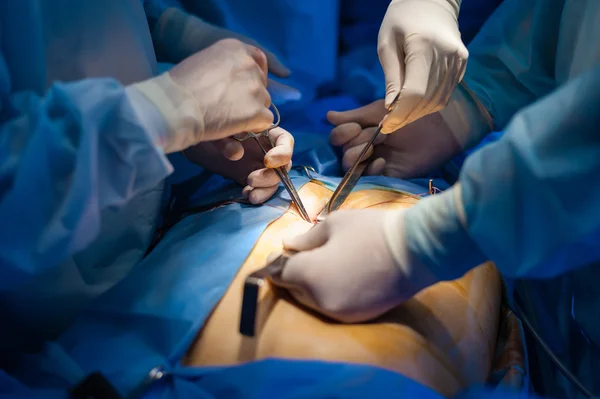 Operation using laparoscopic equipment — Stock Photo, Image