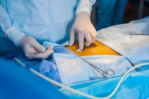 L'opération utilisant l'endoscope en gynécologie — Photo