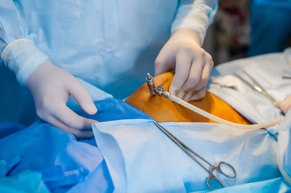 Endoskop kadın hastalıkları içinde kullanarak işlemi