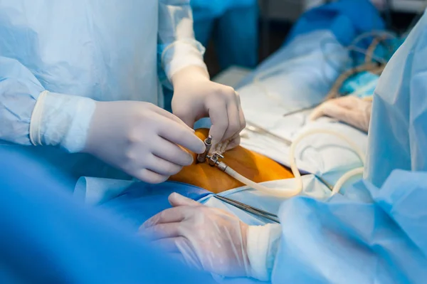 Endoskop kadın hastalıkları içinde kullanarak işlemi