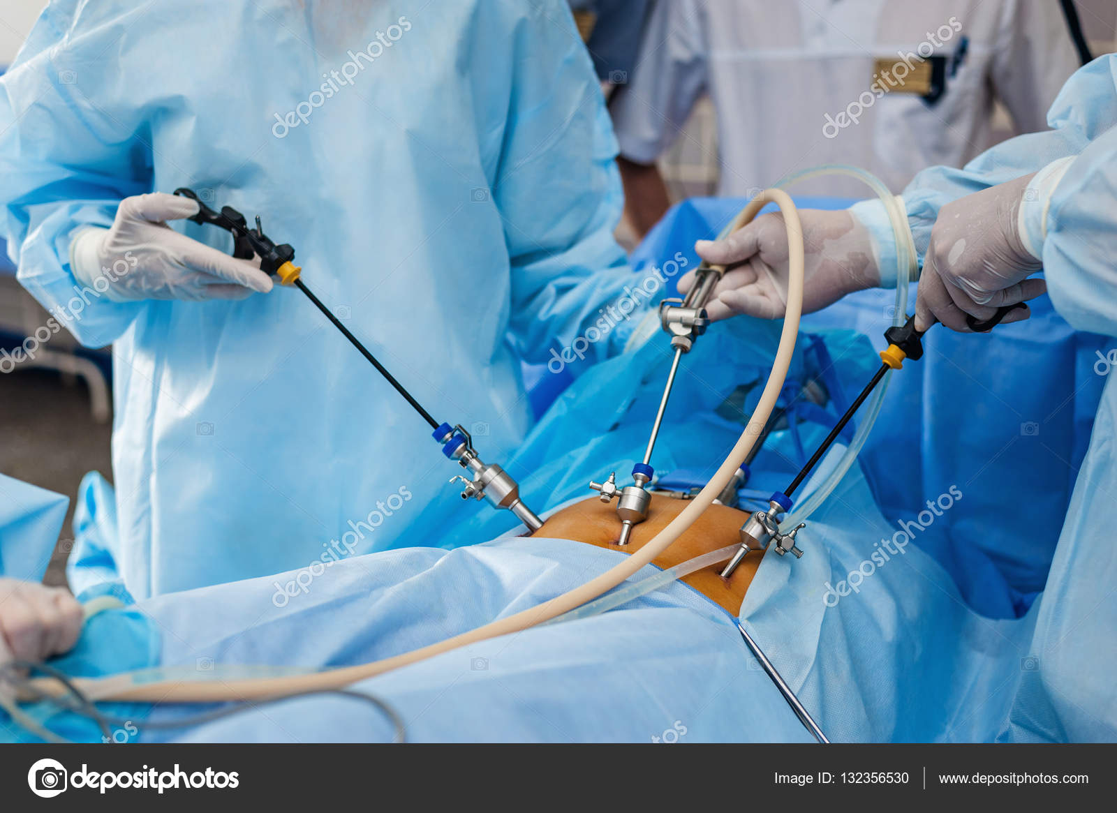 Operation using laparoscopic equipment — Stock Photo © fly_wish 132356530