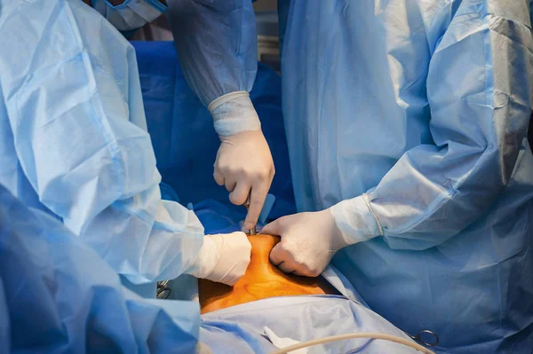 Operação com endoscopia em ginecologia — Fotografia de Stock