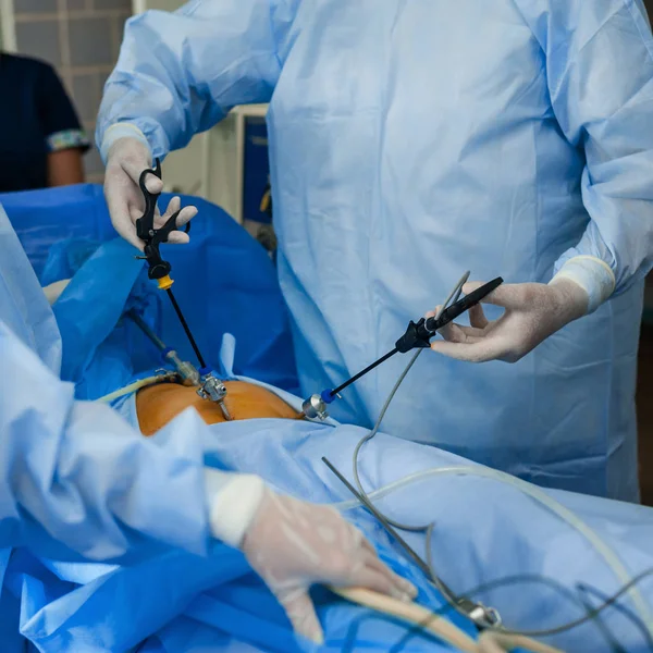 Operation using endoscopic equipment — Stock Photo, Image