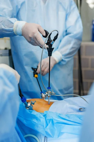 Operation using endoscopic equipment — Stock Photo, Image