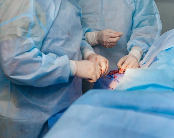 Behandlung von Gefäßerkrankungen mit Angiographie — Stockfoto