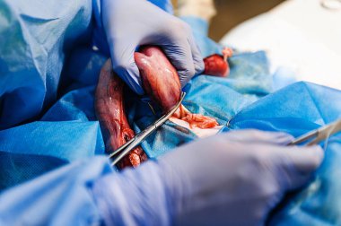 Bir kedideki rahim tümörünü çıkarmak için ameliyat. Veterinerlik cerrahisi. Nörovasküler demire klempler ve dikişler uygulanıyor