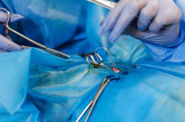 Bir kedideki rahim tümörünü çıkarmak için ameliyat. Veterinerlik cerrahisi. Nörovasküler demire klempler ve dikişler uygulanıyor