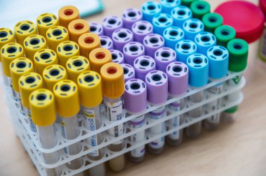 Bir rafta vakum tüpleri seti