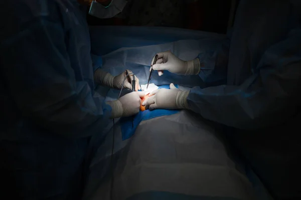 Резекция Опухоли Груди Пластическая Хирургия — стоковое фото