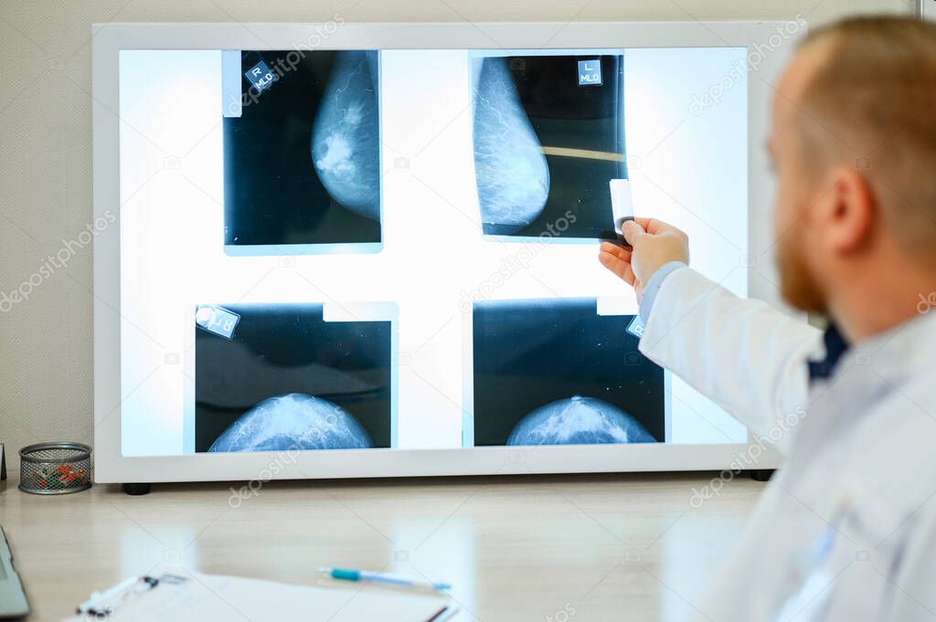 Doctor watching an x-ray picture of a mammary gland in a negatoscope