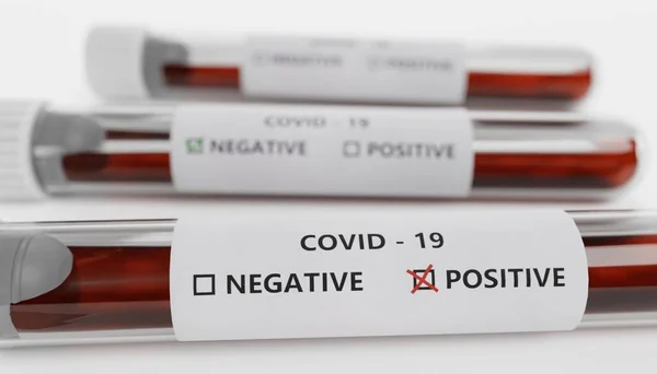 Realistic Render Test Tube Covid Test — Stock Photo, Image