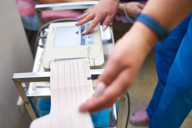 Kardiyografi, kalp atışı ölçümü, sağlık, sağlık analizi