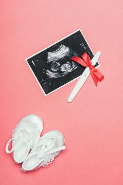 top view of arrangement of childish shoes, ultrasound scan and pregnancy test with ribbon isolated on pink clipart