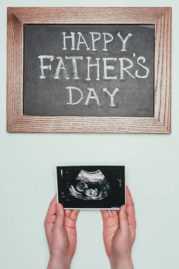 kadının ultrason tarama el ve gri izole mutlu Babalar günü blackboard ile kırpılmış atış