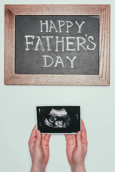 Kadının Ultrason Tarama Gri Izole Mutlu Babalar Günü Blackboard Ile — Stok fotoğraf