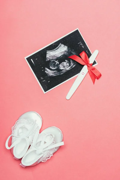 Top view of arrangement of childish shoes, ultrasound scan and pregnancy test with ribbon isolated on pink — Stock Photo