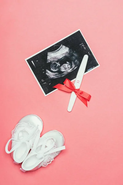 Top view of arrangement of childish shoes, ultrasound scan and pregnancy test with ribbon isolated on pink — Stock Photo