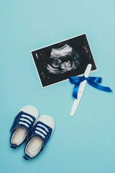 Top view of arrangement of childish shoes, ultrasound scan and pregnancy test with ribbon isolated on blue — Stock Photo