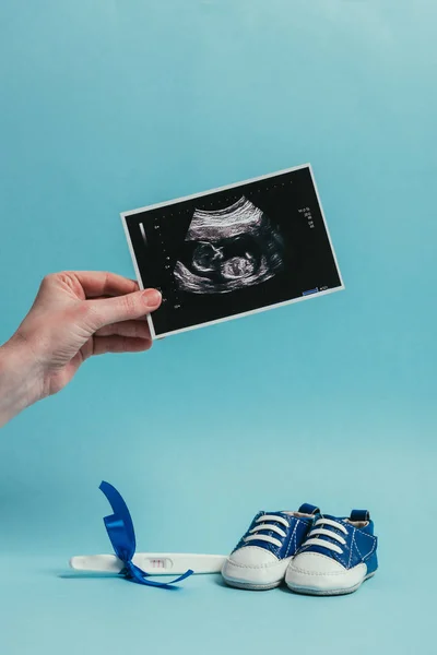 Cropped shot of woman with ultrasound scan in hand, childish shoes and pregnancy test with ribbon isolated on blue — Stock Photo