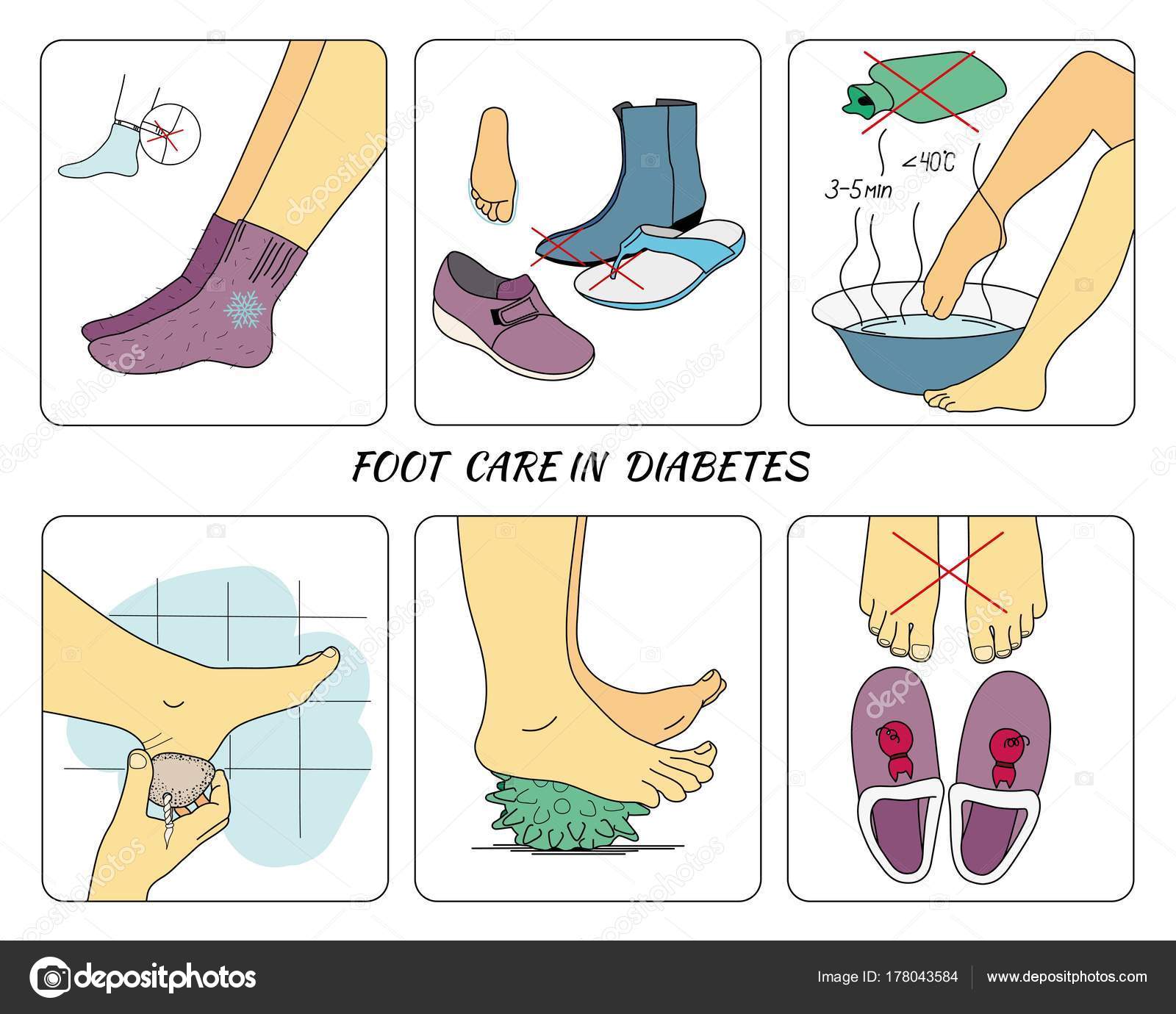 Beteg lábápolási oktatás a cukorbetegségért