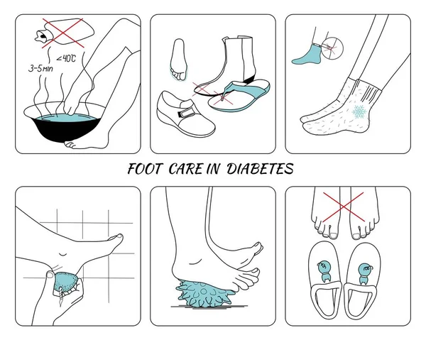 Prevention Diabetic Foot — Stock Vector