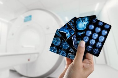 Eller MRI taramalarını tutsun. MR arkaplanı, hastanın boynu ve beyni, el ele tutuşmalar. Baş ağrısı gibi hastalıkların sebebini belirlemek için sinir sistemi organlarının enstrümantal tanı anatomisinin fotoğrafı