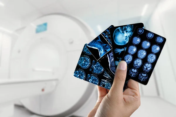 Eller MRI taramalarını tutsun. MR arkaplanı, hastanın boynu ve beyni, el ele tutuşmalar. Baş ağrısı gibi hastalıkların sebebini belirlemek için sinir sistemi organlarının enstrümantal tanı anatomisinin fotoğrafı