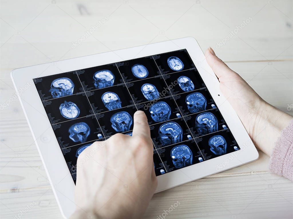 Hands hold MRI scan of head, neck and brain of patient, holding in hands. Concept photo of instrumental diagnostics anatomy of organs of nervous system to determine cause of disease like headache