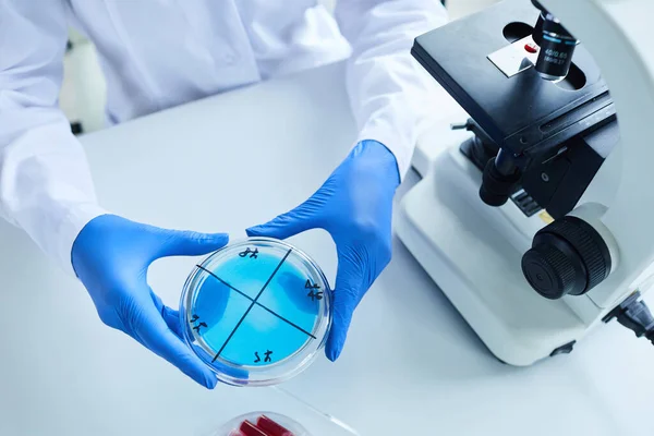 Top View Background Scientist Holding Petri Dish Next Microscope While — Stock Photo, Image