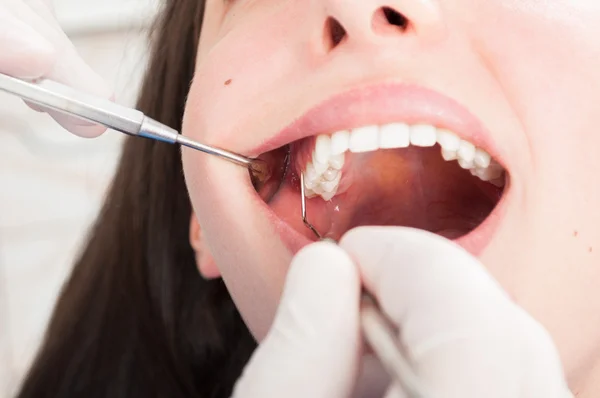 Primo piano della signora che ha il dentista consultare — Foto Stock