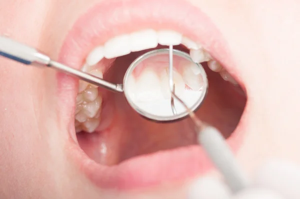 Крупним планом огляд зубів з дзеркалом ортодонта — стокове фото