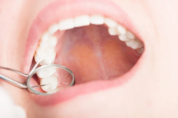 Close-Up diş hekimi ayna ile diş incelemesi — Stok fotoğraf