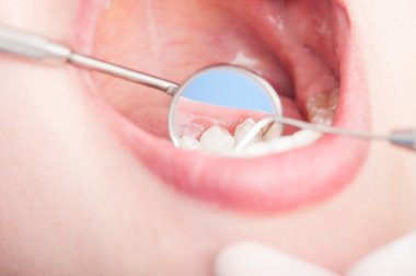 Ortodontist ayna ile diş muayene Close-Up