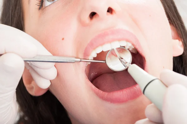 Primer plano de la inspección dental con espejo ortodoncista — Foto de Stock