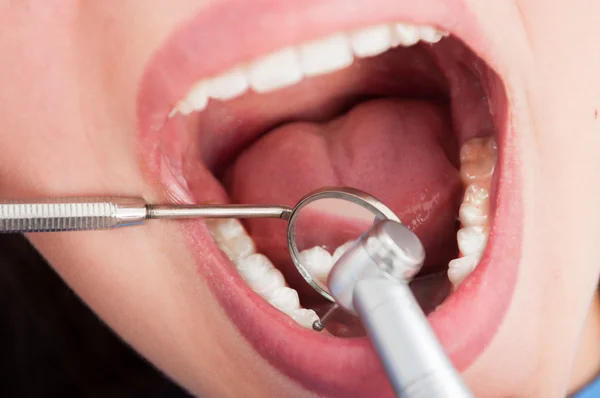 Крупним планом жінка має консультацію стоматолога — стокове фото