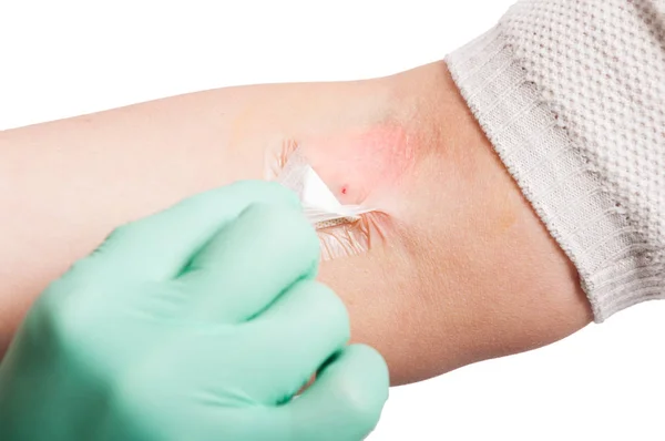 Closeup označit injekce na ženské ruce — Stock fotografie