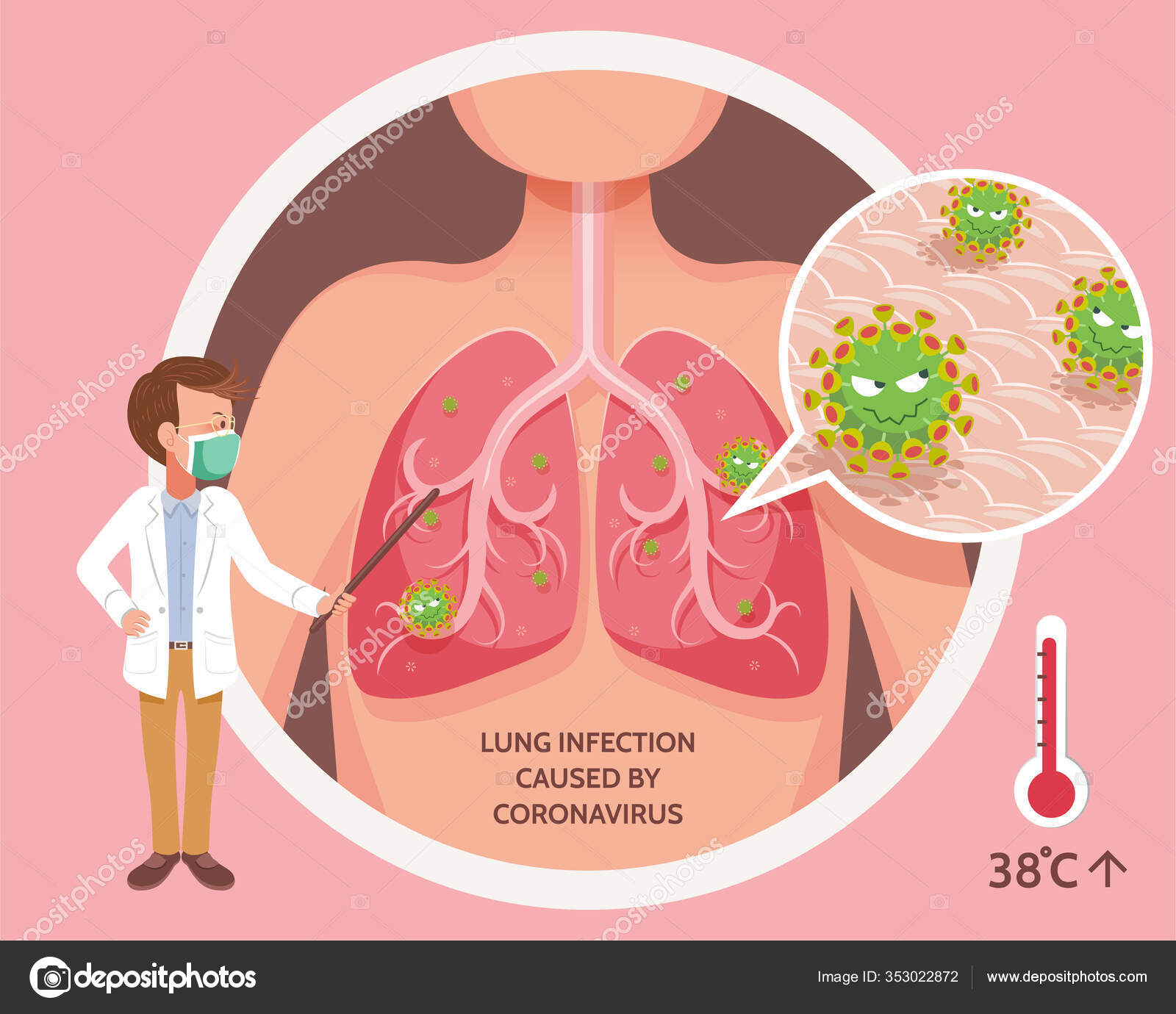 Crypto lung infection Crypto lung infection sa forex expo
