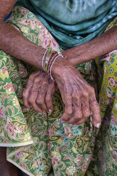 老化过程-老年妇女手部皱纹皮肤 — 图库照片