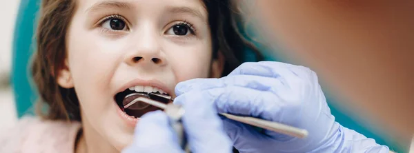 Tanden onderzoek procedure gedaan door een tandarts om een klein blank meisje met geopende mond — Stockfoto