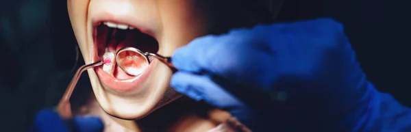 Blank meisje met een stomatologie controle bij de tandarts na een tandheelkundige operatie — Stockfoto