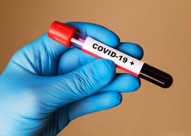 Eldiven içinde tutuş pozitif Coronavirus kan testi sonucu