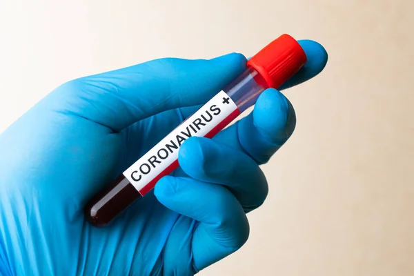 Kéz Kézben Tartsa Pozitív Vérvizsgálat Eredménye Gyorsan Terjedő Coronavirus — Stock Fotó
