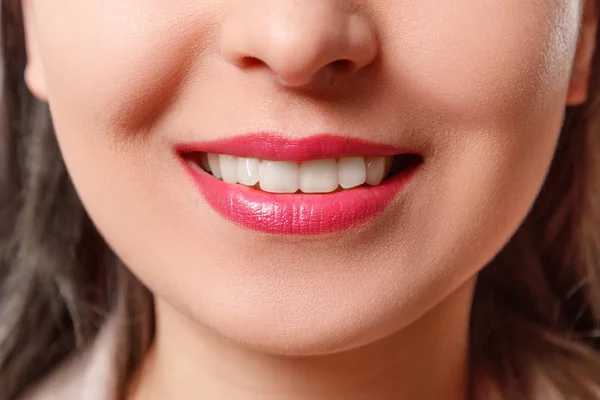 La sonrisa de una joven con dientes blancos perfectos de cerca — Foto de Stock