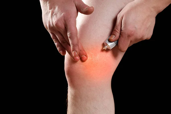 Rubbing medicated ointment into the affected knee — Stock Photo, Image