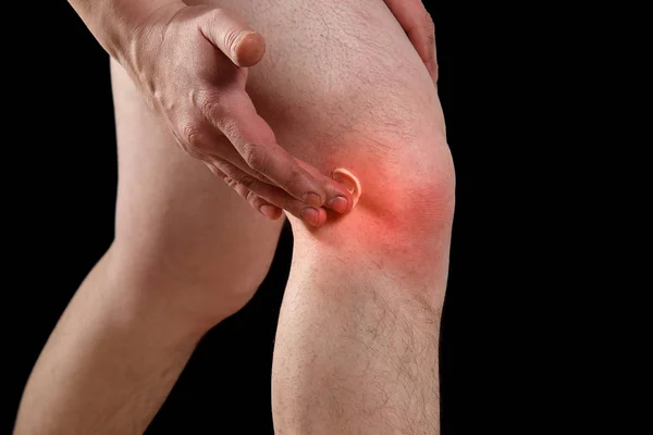 Rubbing medicated ointment into the affected knee — Stock Photo, Image