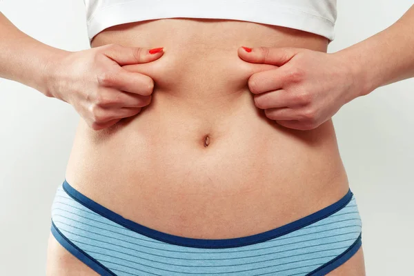 Händer en kvinna håller ett veck av överflödigt fett på magen. om vitt — Stockfoto
