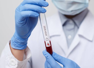 Doktorun elinde kan testi tüpü, analiz için hastanede Mers-Cov Coronavirus etiketi pozitif çıktı. 2019-ncov virüsü Covid-19 enfeksiyonu Çin, Wuhan 'dan kaynaklanıyor.