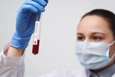 Doktorun elinde kan testi tüpü, analiz için hastanede Mers-Cov Coronavirus etiketi pozitif çıktı. 2019-ncov virüsü Covid-19 enfeksiyonu Çin, Wuhan 'dan kaynaklanıyor.