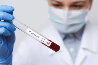 Doktorun elinde kan testi tüpü, analiz için hastanede Mers-Cov Coronavirus etiketi pozitif çıktı. 2019-ncov virüsü Covid-19 enfeksiyonu Çin, Wuhan 'dan kaynaklanıyor.